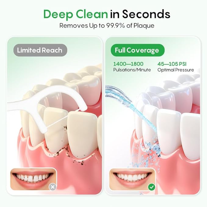 FRESKO Water Dental Flosser for Teeth, 300ML Cordless Flosser with Constant Pressure, Rechargeable Oral Irrigator Cleaner for Travel Home Use and Braces Care, IPX7 Waterproof, 5 Jet Tips