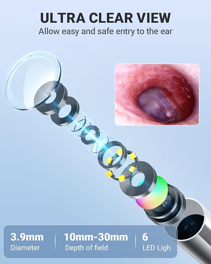 Anykit Digital Otoscope with Gyroscope, 4.5 Inches Screen, 3.9mm Ear Scope Camera with 6 Lights, Ear Wax Removal Tool, 32GB Card, Supports Photo Snap and Video Recording