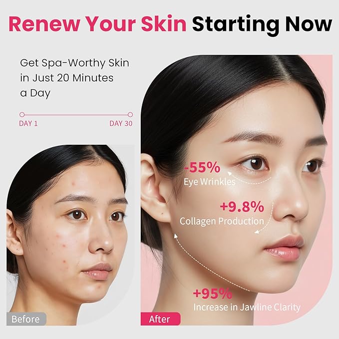 Face Lift Device – 8 in 1 Skin Tightening and Lifting, LED Light Therapy for Wrinkles, Korean Skin Care, Spa-Grade Facial Massager Lifting & Firming Beauty Massager (Pink)