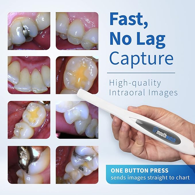 MouthWatch Intraoral Camera, Crystal Clear Images with an Easy to Use, Fast, Single Button Operation Dental Camera, Compatible with Over 50 Dental Imaging Suites, Lightweight and Ergonomic, 31 Grams
