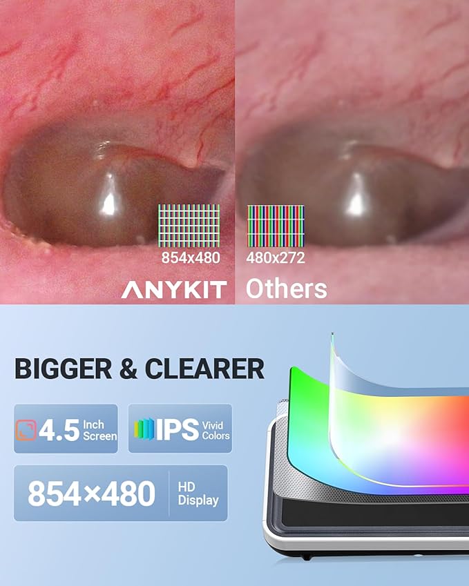 Anykit Digital Otoscope with Gyroscope, 4.5 Inches Screen, 3.9mm Ear Scope Camera with 6 Lights, Ear Wax Removal Tool, 32GB Card, Supports Photo Snap and Video Recording
