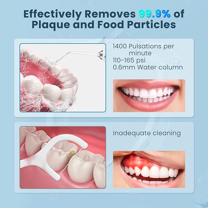 SweetLF Water Dental Flosser Pick for Teeth, 5 Modes Cordless Portable Oral Irrigator, 300ML Tank Water Teeth Cleaner with 5 Jet Tips, IPX7 Waterproof Rechargeable Flossing Picks for Home Travel