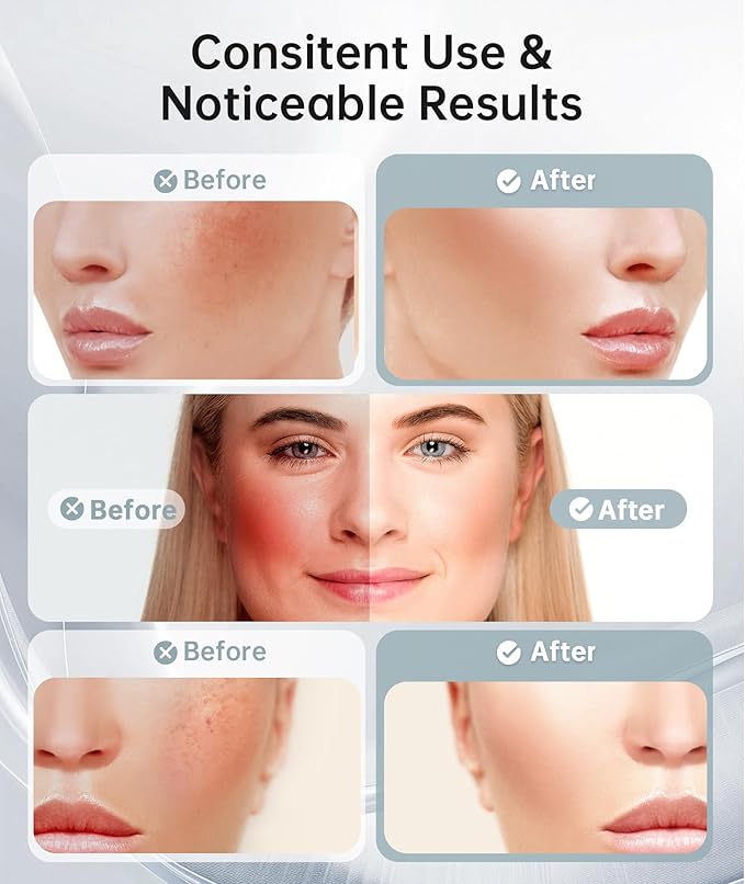 Dopsikn Red Light Therapy for Face and Neck, 7 Color Facial Massager with Adjustable Vibration and Thermals for Wrinkles, Double Chin, Portable Skin Care Tool with Base, White