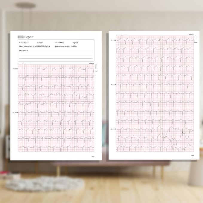 Livenpace 1-Lead Heart Health Monitor at Home, Portable 24 Hours Chest Lead Device with Free AI Analysis & PC Report, Rechargeable Recorder, HHM1