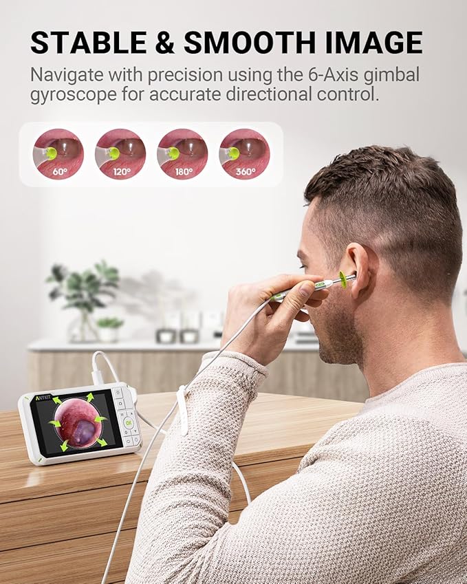 Anykit Digital Otoscope with Gyroscope, 4 Inches Screen, 3.9mm Ear Scope Camera with 6 Lights, Ear Wax Removal Tool, 32GB Card, Supports Photo Snap and Video Recording