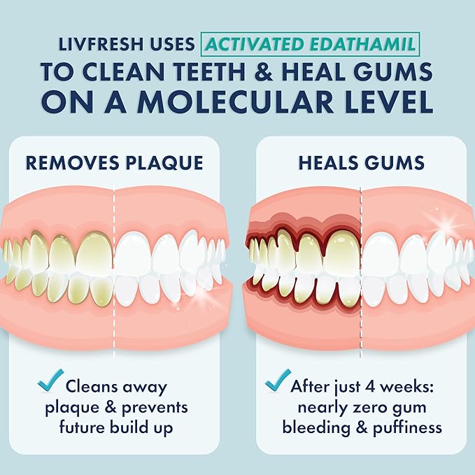 LIVFRESH Toothpaste Gel, Clinically Proven to Remove Plaque 250% Better, Improves Gum Health 190% Better, Prevents & Reduces Tartar, Freshens Breath, SLS Free Dental Gel, Peppermint, 2 Pack